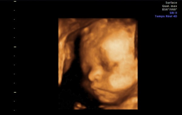 Profil d’un petit bébé de 29 semaines