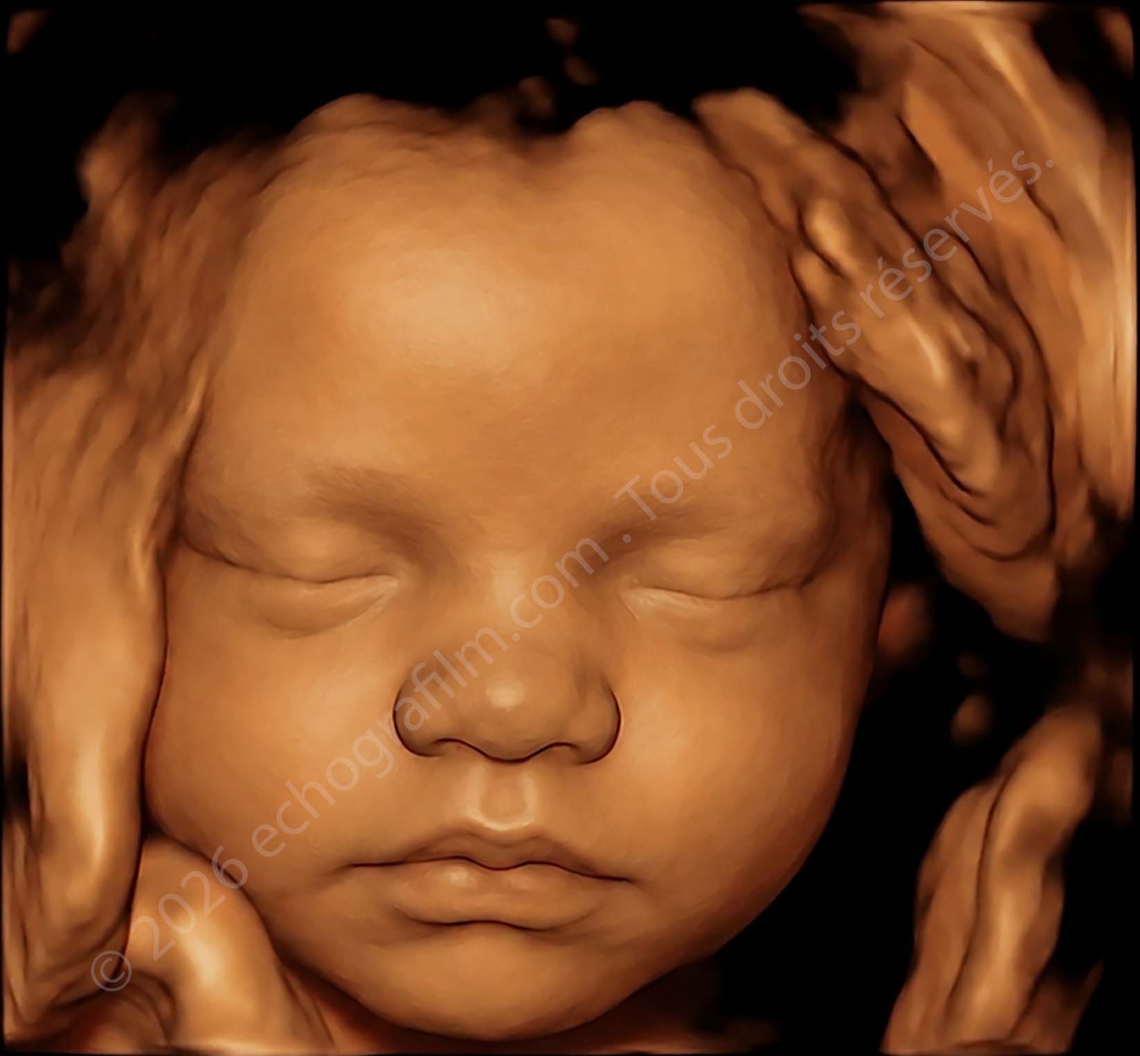 Visage d’un bébé en échographie 3D, les yeux fermés