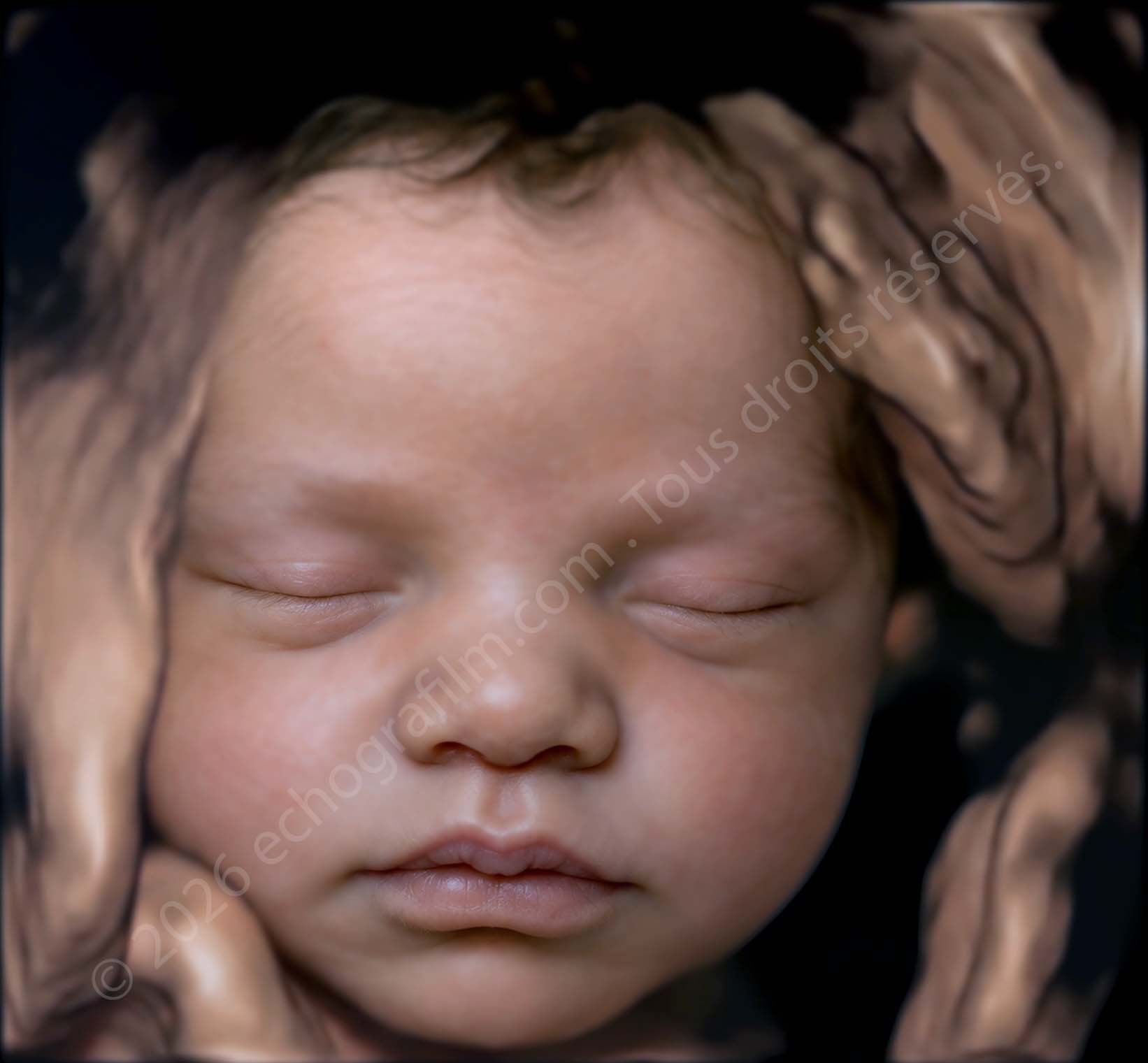 Visage d’un bébé en rendu 6D réaliste amélioré par intelligence artificielle à partir d’une échographie 3D