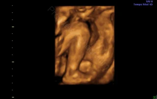 3D ultrasound: baby's legs and feet — Echografilm Paris