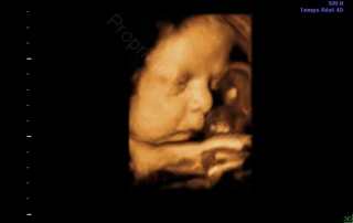 3D ultrasound: baby in profile, hand near the face — Echografilm Paris