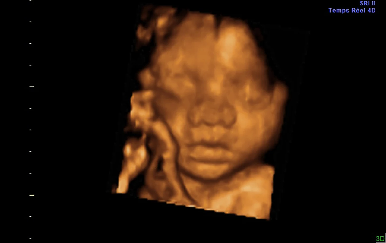 Ecografía 3D: rostro de frente, mano cerca de la mejilla — imagen 3D original
