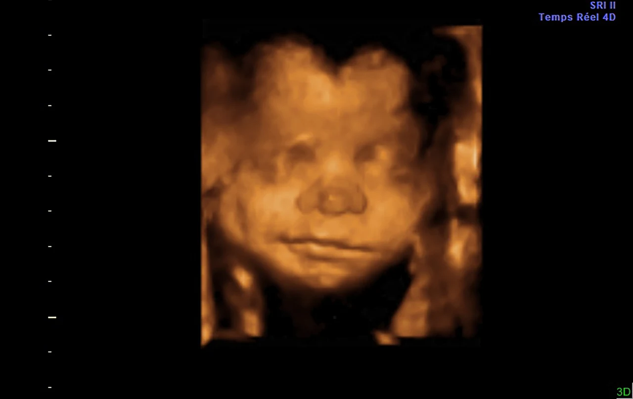 Ecografía 3D: rostro de frente — imagen 3D original