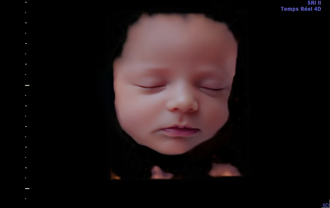 Imagen 6D mejorada con IA: rostro con ojos cerrados — representación 6D Plus con IA