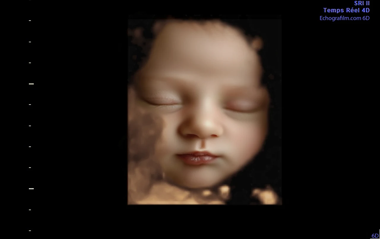Imagen 6D mejorada con IA: rostro de frente con ojos cerrados — representación 6D Plus con IA