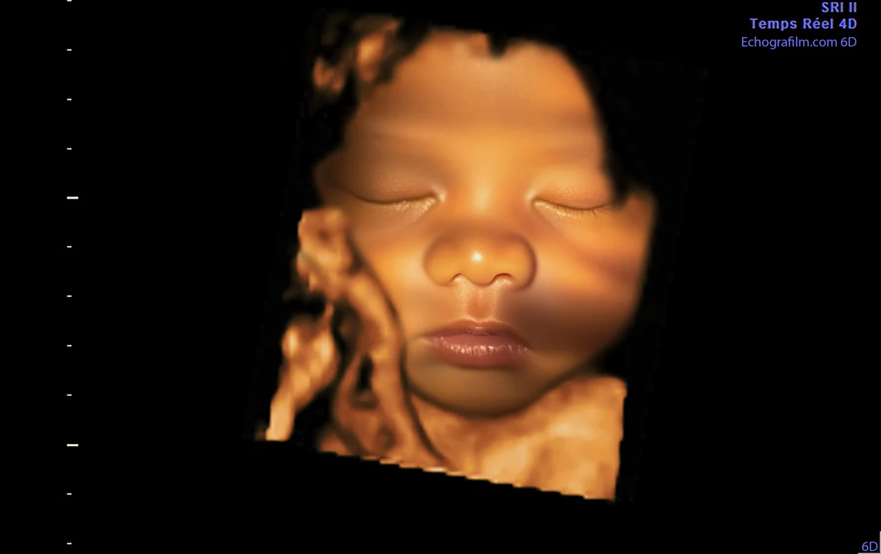 Imagen 6D mejorada con IA: rostro de frente, mano cerca de la mejilla — representación 6D Plus con IA